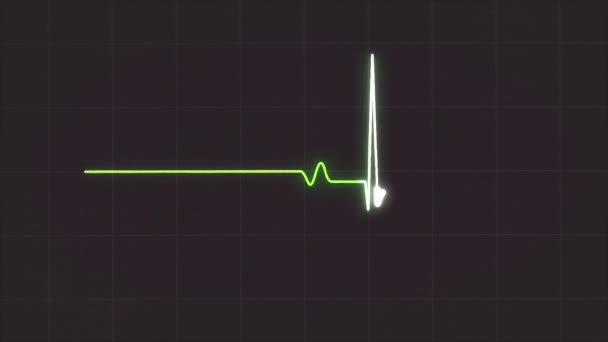 Abstrakti EKG-monitori, jossa näkyy sydämen syke harmaalla taustalla. Elektrokardiogrammi vihreä pulssi aaltoja liikkeessä
. - Materiaali, video