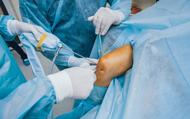 Arthroscope surgery. Orthopedic surgeons in teamwork in the operating room with modern arthroscopic tools. Knee surgery. Hospital background - Foto, Imagen