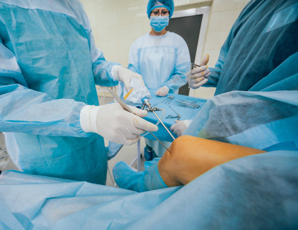Operacja artroskopowa. Chirurdzy ortopedyczni pracują zespołowo na sali operacyjnej z nowoczesnymi narzędziami artroskopowymi. Operacja kolana. Otoczenie szpitala - Zdjęcie, obraz