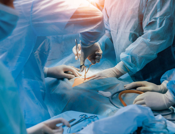 Process of gynecological surgery operation using laparoscopic equipment. Group of surgeons in operating room with surgery equipment. Background - Zdjęcie, obraz