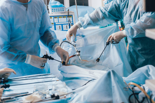 Process of gynecological surgery operation using laparoscopic equipment. Group of surgeons in operating room with surgery equipment. Background - Foto, Bild