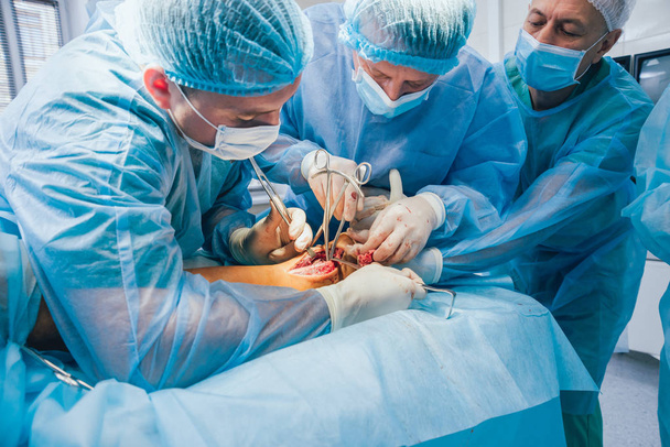 Process of trauma surgery operation. Group of surgeons in operating room with surgery equipment. Medical background - Fotó, kép