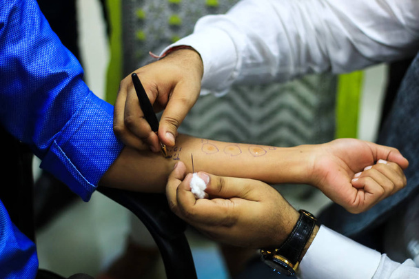 Cilt Anti test hazırlık bir hasta el kullanma doktor tarafından  - Fotoğraf, Görsel