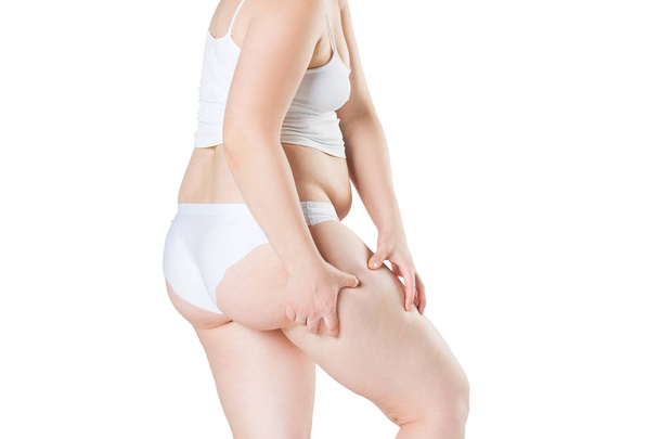 Overweight woman with fat thighs, obesity female legs isolated on white background - Fotoğraf, Görsel