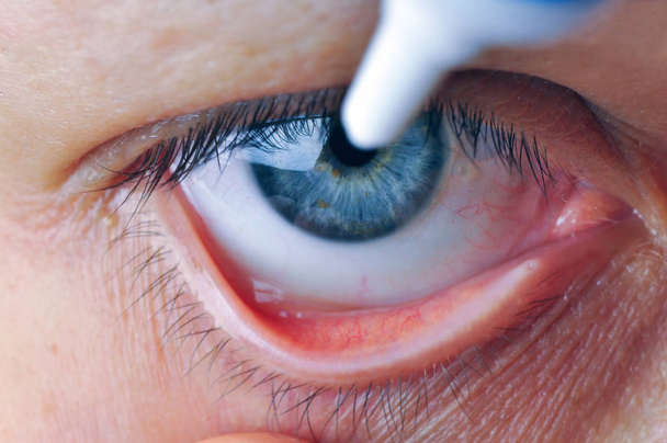 Instill eyedrops or ointment on eye. - Photo, Image