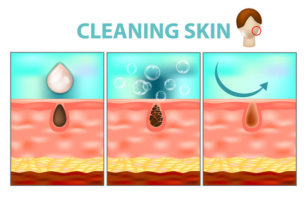 Gesichtspflege und Reinigungswerkzeuge. Hautreinigung zu Hause Schritt für Schritt - Verfahren reinigen verstopfte Poren im Gesicht. - Vektor, Bild