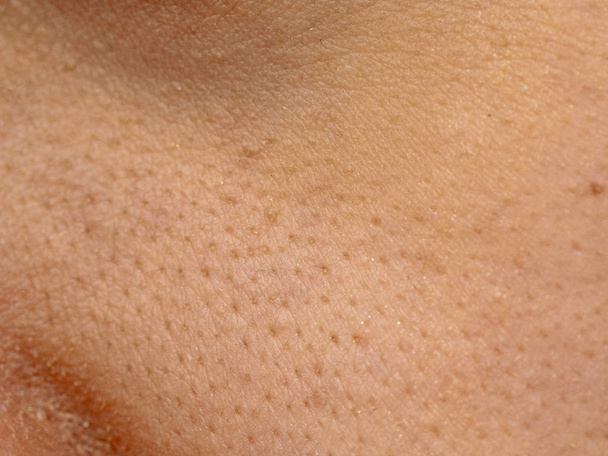 chiuda la pelle di pori larga su faccia secca di donna asiatica, naso femminile e problema della pelle di guancia, grandi pori, whitehead e brufolo di punto nero
 - Foto, immagini