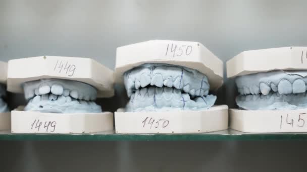 Οδοντιατρική γύψου μοντέλα ρίχνει από μια ανθρώπινη γνάθου οδοντιατρική - Πλάνα, βίντεο