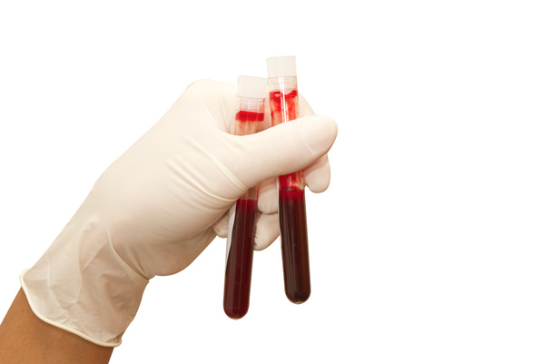 γιατρός χέρι με αίμα σωλήνες δοκιμής που απομονώνονται σε λευκό με διαδρομή - Φωτογραφία, εικόνα