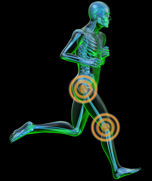 Zijaanzicht van een lopende man gezien door x-ray met pijn in het been - Foto, afbeelding