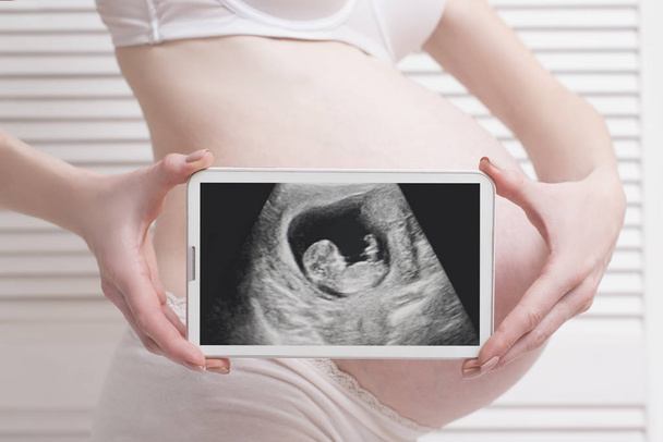 Kobieta w ciąży w bielizny gospodarstwa i Wyświetlono cyfrowego tabletu z zdjęcie USG płodu na białym tle drewnianych. Szczelnie-do góry - Zdjęcie, obraz