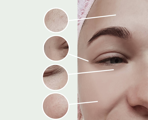 arrugas de la mujer antes y después de los procedimientos collage
 - Foto, Imagen