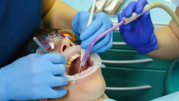 現代の歯科医のオフィス。歯科治療のクローズ アップ ショット。メスの患者は、歯の治療を取得します。歯科医のツールを使用して、真空、ドリル、機器、クリニックの器械。4 k - 映像、動画