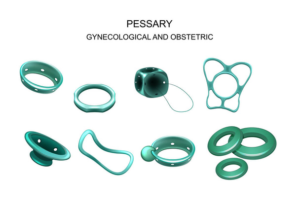pessary gynécologique et obstétrique
 - Vecteur, image