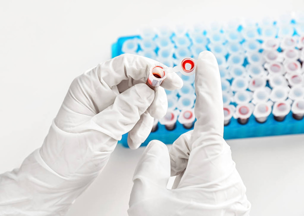 Laborangestellte hält Reagenzglas mit Blut, Nahaufnahme - Foto, Bild