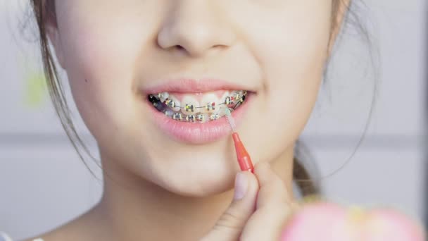 Dospívající dívka, úklid a čištění zubů s jasnou kovových rovnátek - Záběry, video