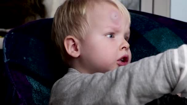 ein großer Bluterguss auf der Stirn eines kleinen Jungen - Filmmaterial, Video