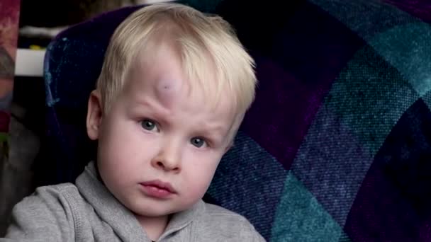 ein großer Bluterguss auf der Stirn eines kleinen Jungen - Filmmaterial, Video