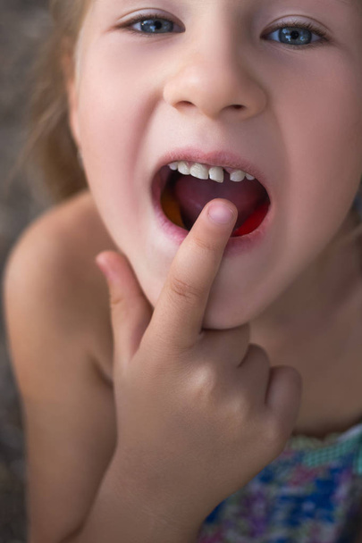 Маленькая девочка показывает пальцем на шаткий молочный зуб - Фото, изображение