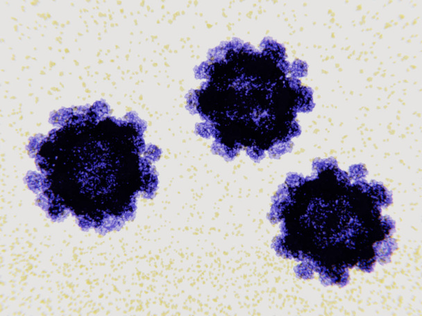 A norovirus fertőzés a leggyakoribb oka a gyomor-bél hurutot. Fertőzés jellemzi hasmenés, hányás és hasi fájdalom. - Fotó, kép