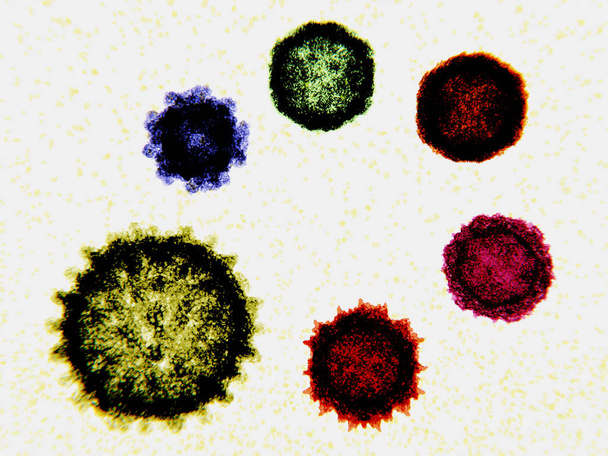 時計回りに左下から: インフルエンザ ウイルス、ノロウイルス、コクサッキー ウイルス、エンテロ ウイルス D68、ポリオ ウイルス、関連付けられているアデノ ウイルス。ウイルスは伝染性の粒子、細菌よりも小さいし、宿主細胞を感染した後彼自身を再現できるだけ。彼らが - 写真・画像