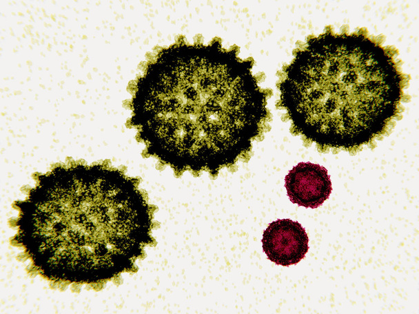 C-hepatiittivirus on halkaisijaltaan 80-120 nm RNA-virus. Poliovirus on yksinkertainen halkaisijaltaan 30 nm:n RNA-virus. Poliovirus aiheuttaa poliomyeliitin
. - Valokuva, kuva
