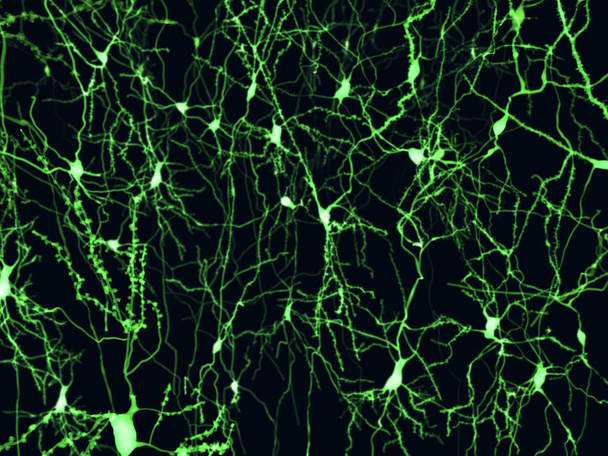 Neuronas corticales marcadas por fluorescencia. Ilustración
 - Foto, imagen