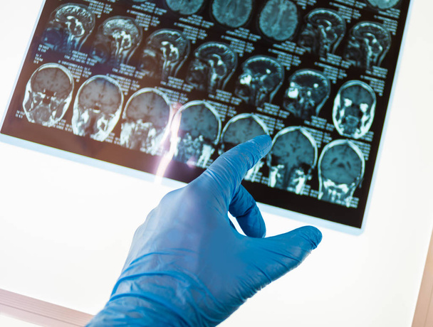Arzt zeigt auf Röntgenbild des Gehirns - Foto, Bild
