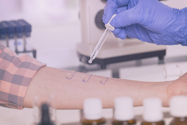 Allergy tests in laboratory - Photo, Image