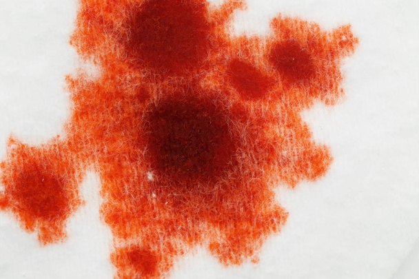 Gotas de sangre en la almohadilla de algodón, vista de cerca
 - Foto, imagen
