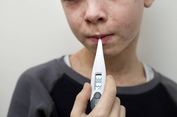 Portret dziecka chory, smutny chłopiec z termometrem o gorączka suf - Zdjęcie, obraz