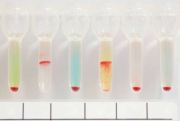 Blood group ABO typing gel test. - Photo, Image