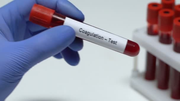 Coagulation-Test, doctor holding blood sample in tube close-up, health check-up - Video