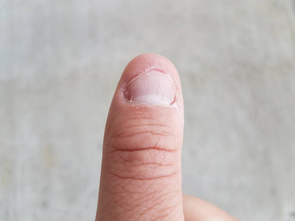 gebeten of gekauwd vingernagel en grijs cement - Foto, afbeelding
