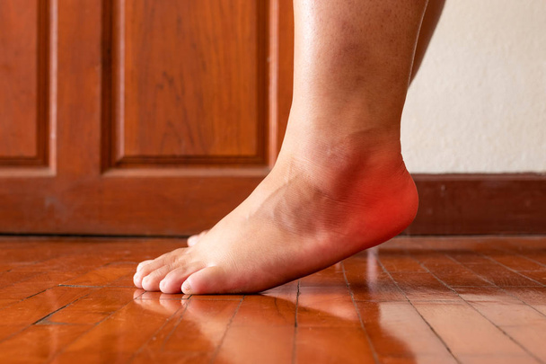 Female foot heel pain or plantar fasciitis. Health care concept. - Photo, Image