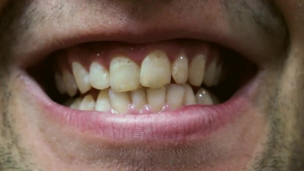 Zbliżenie na uśmiechnięty człowiek zęby w recepcji Dentyści. - Materiał filmowy, wideo