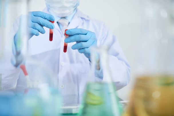 Nahaufnahme eines Technikers, der Fläschchen mit Blut in Schutzhandschuhen hält, während er an der Forschung im Labor arbeitet - Foto, Bild