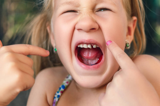 Menina aponta o dedo para um dente de leite oscilante - Foto, Imagem