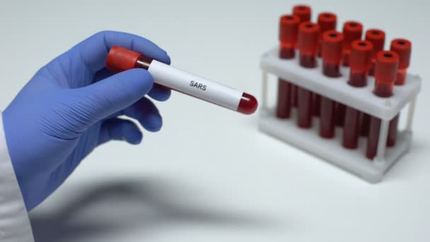 SARS test, doctor showing blood sample in tube, lab research, health checkup - Filmati, video