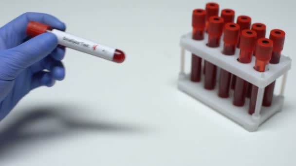 Negative Smallpox test, doctor showing blood sample in tube, health checkup - Filmagem, Vídeo