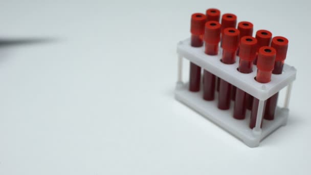 Positive Enterovirus test, doctor showing blood sample in tube, health checkup - 映像、動画