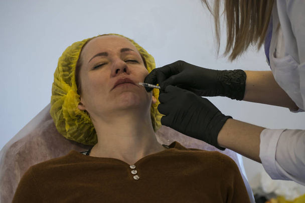 Kosmetologi tekee injektio Botox alueella huulet
. - Valokuva, kuva