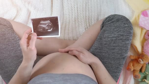 Pregnant woman holding ultrasound image. Concept of pregnancy. Top view - Materiał filmowy, wideo