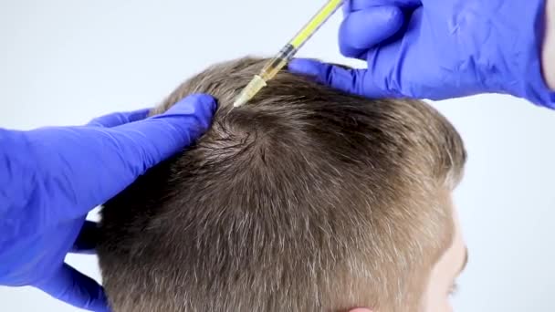 Mezoterápia haj vagy a haj transzplantáció: kozmetikus orvos teszi injekció a mans fej haj növekedését és megakadályozza a kopaszodást - Felvétel, videó
