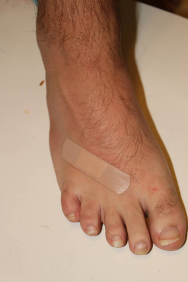 Kontuzjowana stopa z krwawieniem rany na białym tle. - Zdjęcie, obraz