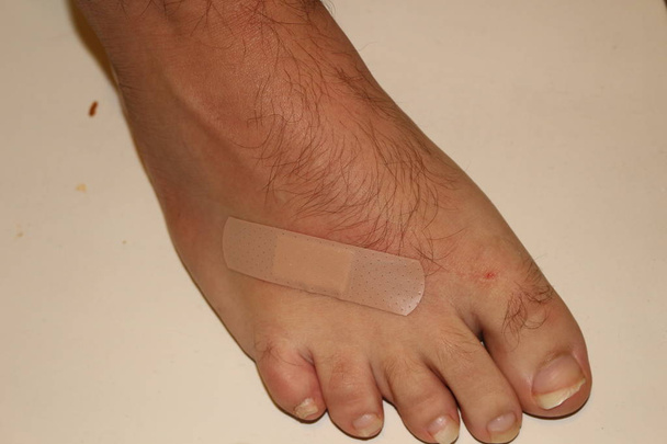 Τραυματισμένο πόδι με αιμορραγία πληγή από τριβή απομονωμένη σε λευκό φόντο. - Φωτογραφία, εικόνα