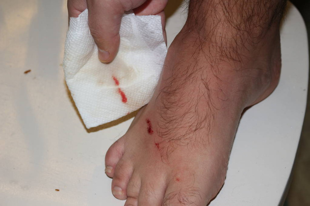 verletzter Fuß mit blutender Schürfwunde isoliert auf weißem Hintergrund. - Foto, Bild