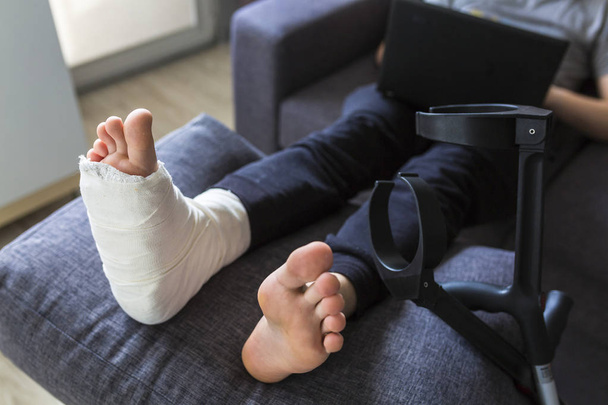 grounded at home with a leg in a cast - Fotoğraf, Görsel