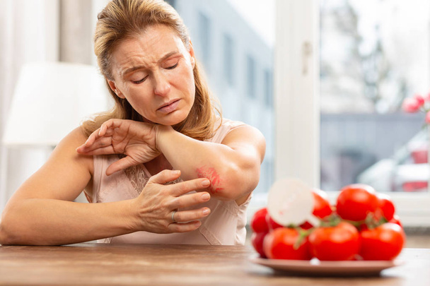 Woman having rash and scratches on elbow because of allergy - Φωτογραφία, εικόνα