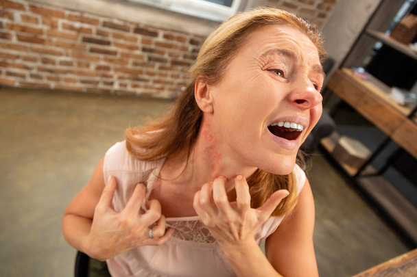 Aged woman having rash and reddening on her neck after allergy - Foto, afbeelding